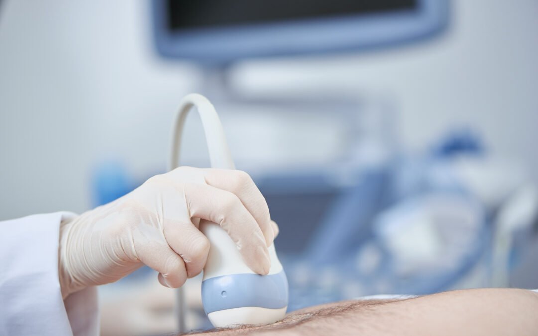 FibroScan for Fatty Liver: What It Can Tell You About Liver Fat and Fibrosis