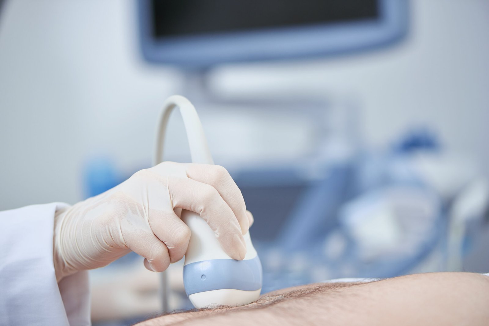 FibroScan for Fatty Liver: What It Can Tell You About Liver Fat and Fibrosis