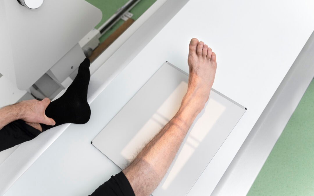 Am I at Risk for Osteoporosis? When to Consider a Bone Density Test